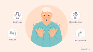 Parkinson 1