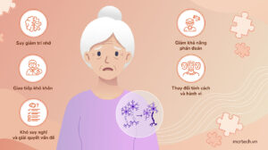 Alzheimer 1