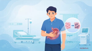 Gastric cancer