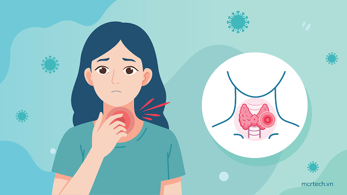Thyroid cancer